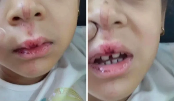 Crianca de 4 anos e atropelada por bike eletrica